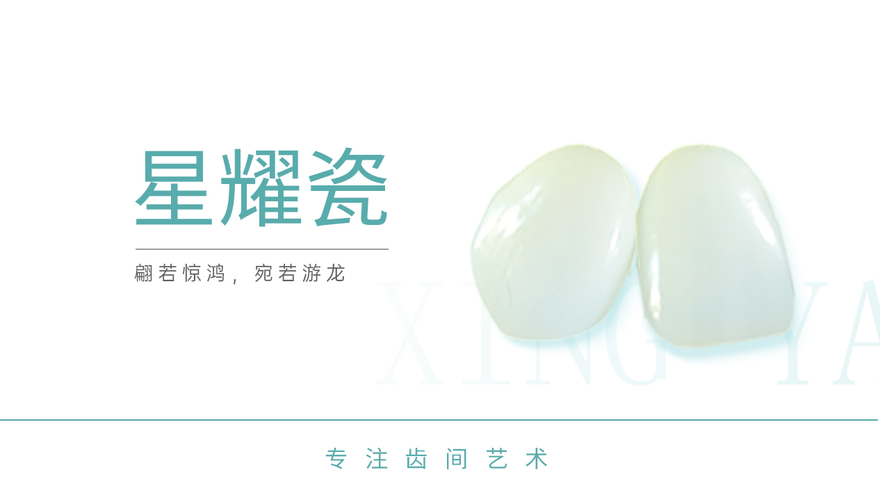星耀瓷